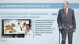 Historial de operaciones del rey Historial de operaciones del rey