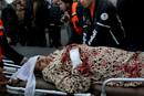 Una mujer herida durante un ataque a&eacute;reo israel&iacute; es trasladada al hospital Kmal Idwan, en el campo de refugiados de Yabalia, en la Franja de Gaza.