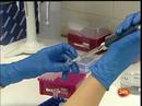 Ir al Video&nbsp;El 40% de los casos de c&aacute;ncer se pueden evitar