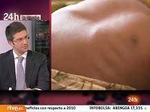 Ir al Video&nbsp;"90 millones en 90 d&iacute;as": una campa&ntilde;a para paliar la hambruna en el Cuerno de &Aacute;frica