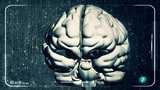 Ir al Video&nbsp;I + - Alzheimer