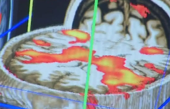 Una nueva tecnolog&iacute;a de esc&aacute;ner cerebral detecta la parte del cerebro que activa su respuesta