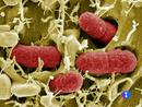 Ir al Video&nbsp;La bacteria E.Coli, responsable de las muertes en Alemania