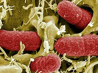 Ver v&iacute;deo  'La bacteria E.Coli, responsable de las muertes en Alemania'