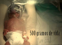 bebes prematuros 1