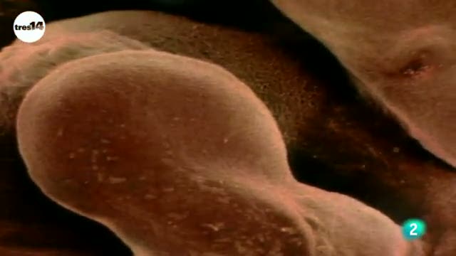 tres14 - Curiosidades cient&iacute;ficas - Los beb&eacute;s tienen m&aacute;s huesos que los adultos