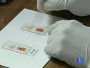 Ir al Video&nbsp;Brote de malaria en Grecia