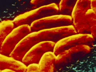 Ver v&iacute;deo  'El c&aacute;ncer de colon es el tumor maligno m&aacute;s extendido y el segundo en mortalidad en Espa&ntilde;a'