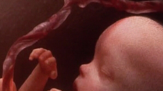 C&eacute;lulas madre, un cord&oacute;n vital. Avance