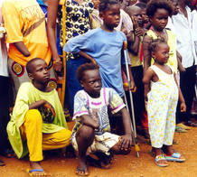 CHILD AMPUTEES WAIT FOR A VISIT BY CANADIAN FOREIGN MINISTER.