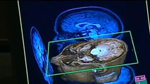 Ir al Video&nbsp;Un cient&iacute;fico espa&ntilde;ol lidera el proyecto para crear un mapa del cerebro humano