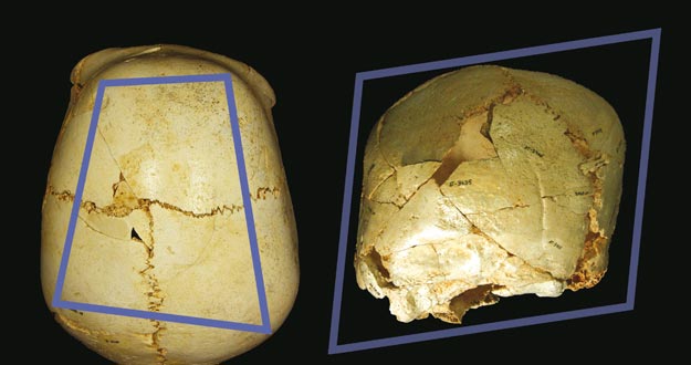 CIENT&Iacute;FICOS HALLAN EN ATAPUERCA UN CR&Aacute;NEO CON UNA RARA ENFERMEDAD CONG&Eacute;NITA
