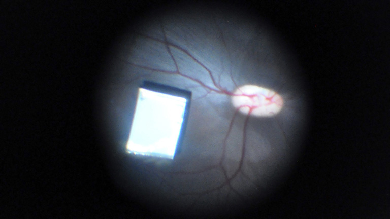 Científicos israelíes desarrollan una nano retina, un chip que devuelve parcialmente la vista