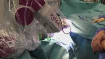 Ir al Video&nbsp;Cirug&iacute;a robotizada para el c&aacute;ncer cerebral