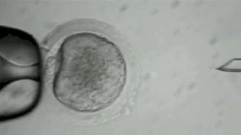 Centíficos estadounidenses logran clonar células madre humanas