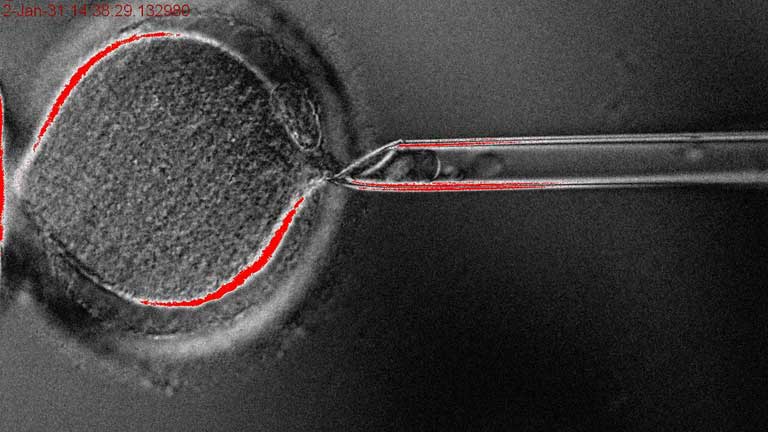 Investigadores americanos logran convertir células de piel humana en células madre embrionarias
