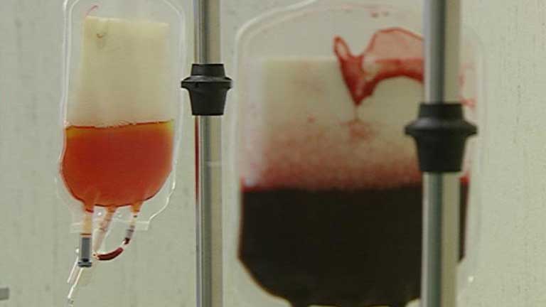 Las enfermedades cardiovasculares podr&iacute;an estar inducidas por un problema con las c&eacute;lulas madre