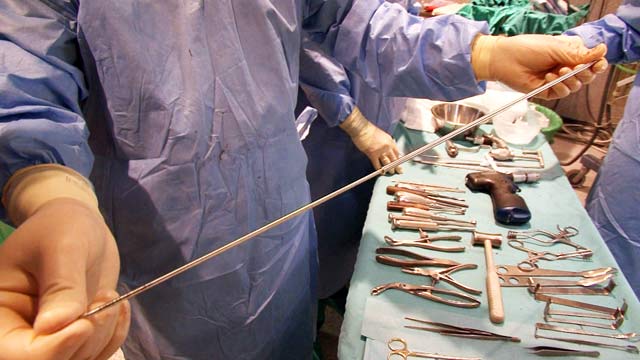 Comando actualidad - Milagro m&eacute;dico - Huesos de cristal