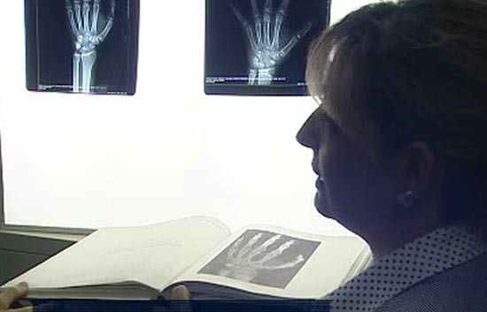 &iquest;C&oacute;mo averigua un forense la edad de una persona?