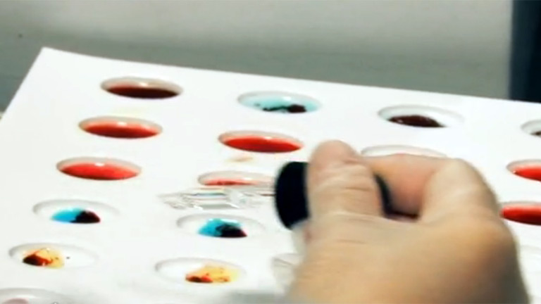 Redes - C&oacute;mo curan las c&eacute;lulas madre