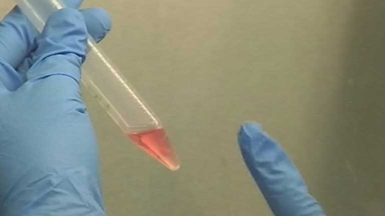 Cient&iacute;ficos descubren c&oacute;mo regenerar el cart&iacute;lago da&ntilde;ado en pacientes con osteoartritis