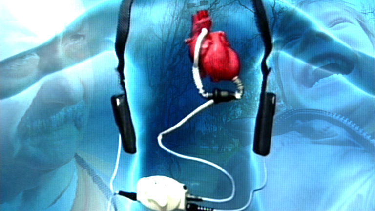 Documentos TV - Corazones artificiales. Impulsos de vida - Avance