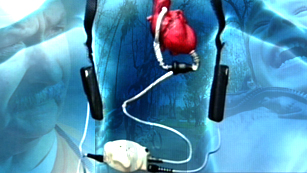 "Corazones artificiales. Impulsos de vida"