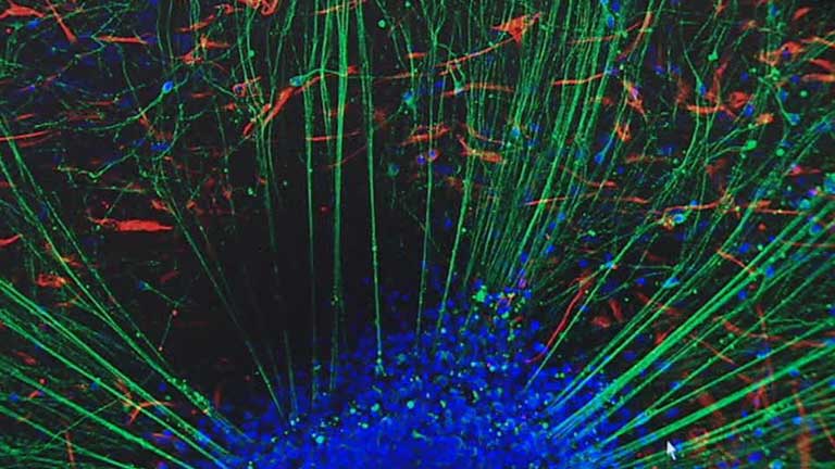 Investigadores logran convertir células de sangre del cordón umbilical en neuronas