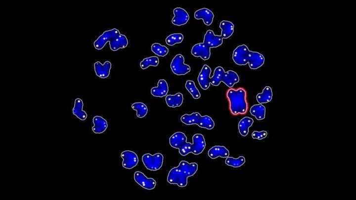 Cromosomas anómalos en células reprogramadas a las que se les ha eliminado la proteína SIRT1 (rojo).
