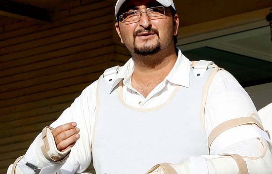 Dado de alta el hombre transplantado de los dos brazos