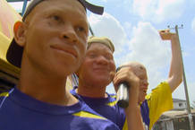 docu-albinos2 docu-albinos2