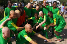 docu-albinos3 docu-albinos3