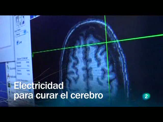 Redes - Electricidad para curar el cerebro 