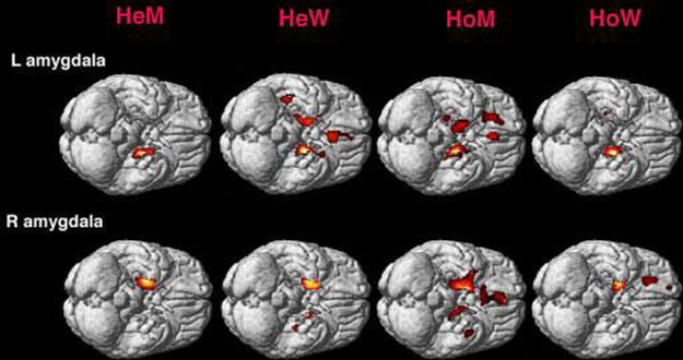 Escáner cerebral de hombres y mujeres Escáner cerebral de hombres y mujeres