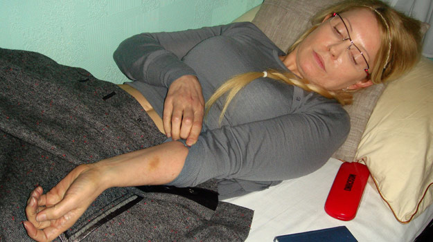 Fotografía de Yulia Tymoshenko, que muestra las supuestas heridas causadas por los guardias, el pasado 25 de abril Fotografía de Yulia Tymoshenko, que muestra las supuestas heridas causadas por los guardias, el pasado 25 de abril