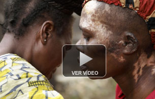 Ver v&iacute;deo  'Las heridas de Fran&ccedil;oise'
