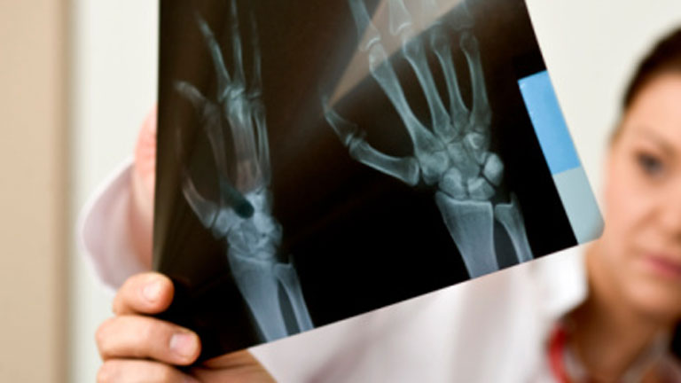 Saber vivir  -  Huesos fuertes 12/06/12