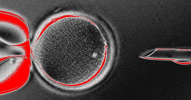 Células madres a partir de la piel estimulan medicina regenerativa