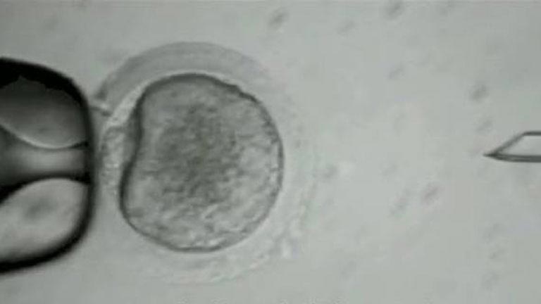 Investigadores logran convertir células de piel humana en células madre embrionarias