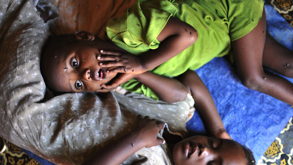 Dos niños son atendidos en un campo de refugiados del Cuerno de África. Dos niños son atendidos en un campo de refugiados del Cuerno de África.