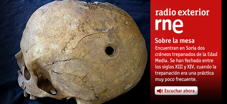 Imagen Sobre la mesa - Encuentran en Soria dos cr&aacute;neos trepanados de la Edad Media - 17/05/12