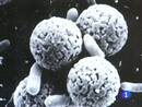 Ir al Video&nbsp;El laboratorio de referencia de la bacteria E. coli se encuentra en Lugo