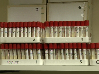 Ver v&iacute;deo  'El laboratorio de referencia de la bacteria E. coli se encuentra en Lugo'