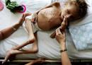 El ni&ntilde;os de nueve a&ntilde;os Jason L&oacute;pez descansa en la cama del hospital Catarino Rivas, en Honduras, con riesgo serio de malnutrici&oacute;n.