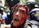Manifestante herida por la Polic&iacute;a