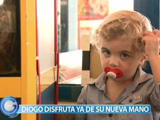M�s Gente - El peque�o Diogo ya tiene dos manos