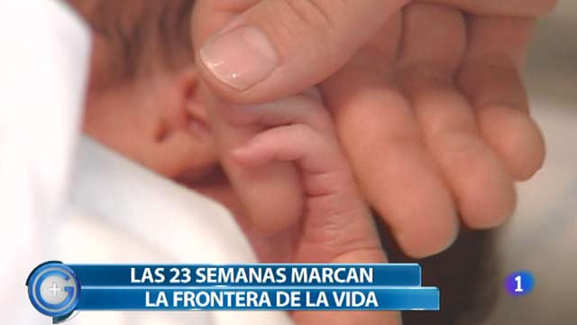Ir al Video&nbsp;M&aacute;s Gente - Uno de cada 10 reci&eacute;n nacidos es beb&eacute; prematuro