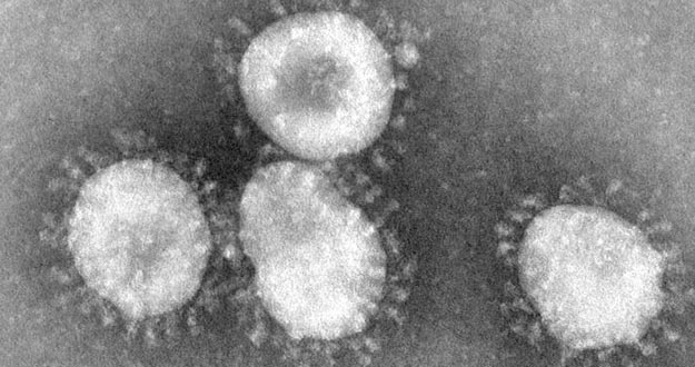 Muere un paciente en Arabia Saud&iacute; por el nuevo coronavirus