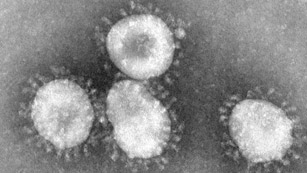 Muere un paciente en Arabia Saudí por el nuevo coronavirus Muere un paciente en Arabia Saudí por el nuevo coronavirus