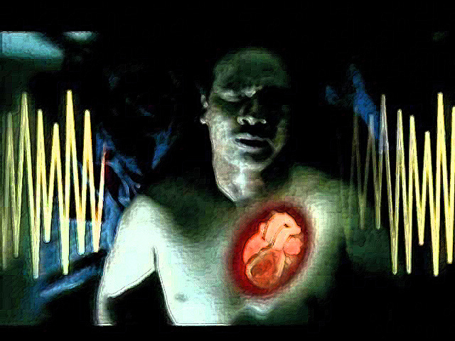La muerte súbita cardiaca (parada cardiorrespiratoria o PCR) es un problema de salud de primer orden